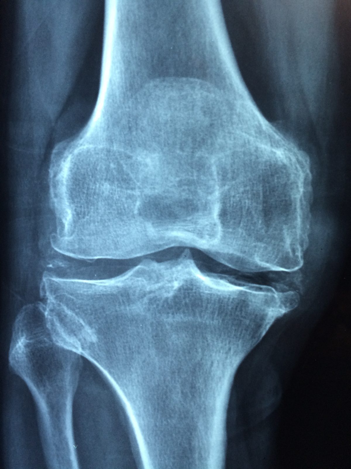 hand-trunk-old-leg-human-care-619689-pxhere.com