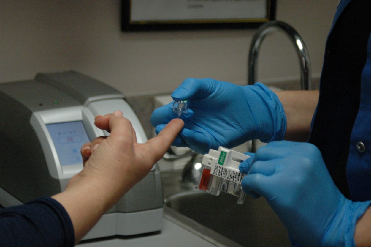 person-arm-human-body-organ-nurse-diabetes-924261-pxhere.com